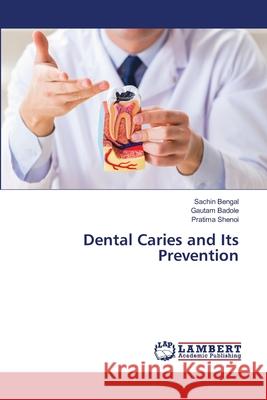 Dental Caries and Its Prevention Sachin Bengal Gautam Badole Pratima Shenoi 9786203196658