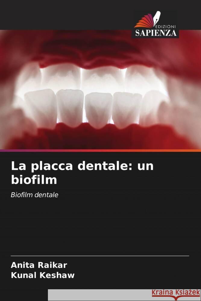 La placca dentale: un biofilm Anita Raikar Kunal Keshaw 9786203199215