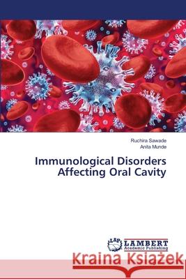 Immunological Disorders Affecting Oral Cavity Ruchira Sawade Anita Munde 9786203200270