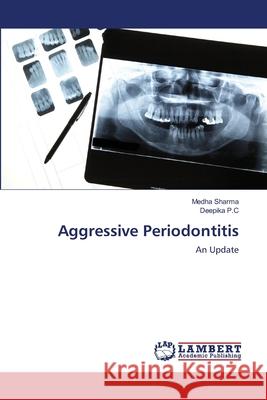 Aggressive Periodontitis Medha Sharma Deepika P 9786203200690