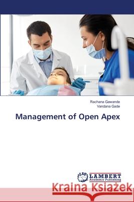 Management of Open Apex Rachana Gawande Vandana Gade 9786203201475
