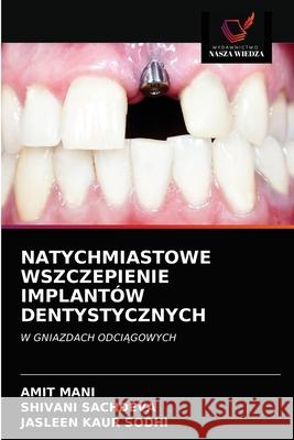 Natychmiastowe Wszczepienie Implantów Dentystycznych Mani, Amit 9786203216509 Wydawnictwo Nasza Wiedza