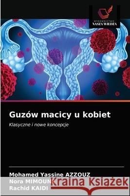 Guzów macicy u kobiet Azzouz, Mohamed Yassine 9786203216950 Wydawnictwo Nasza Wiedza