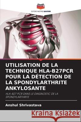 Utilisation de la Technique Hla-B27pcr Pour La Détection de la Spondylarthrite Ankylosante Anshul Shrivastava 9786203239515 Editions Notre Savoir