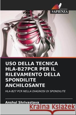 USO Della Tecnica Hla-B27pcr Per Il Rilevamento Della Spondilite Anchilosante Anshul Shrivastava 9786203239539 Edizioni Sapienza