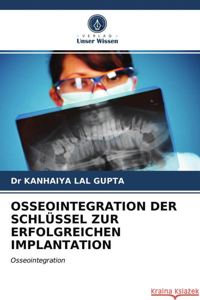 OSSEOINTEGRATION DER SCHLÜSSEL ZUR ERFOLGREICHEN IMPLANTATION LAL GUPTA, Dr KANHAIYA 9786203292954