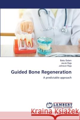 Guided Bone Regeneration Babu Salam Jacob Raja Johnson Raja 9786203303902 LAP Lambert Academic Publishing