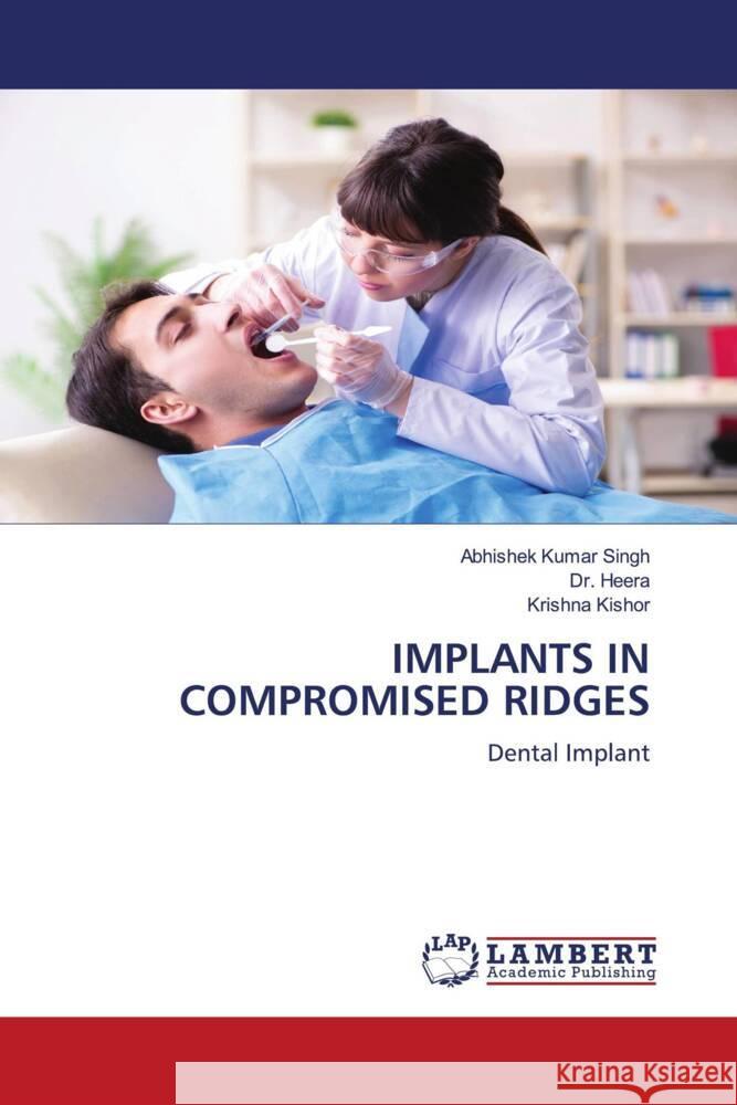 IMPLANTS IN COMPROMISED RIDGES Singh, Abhishek Kumar, Heera, Dr., Kishor, Krishna 9786203305043 LAP Lambert Academic Publishing