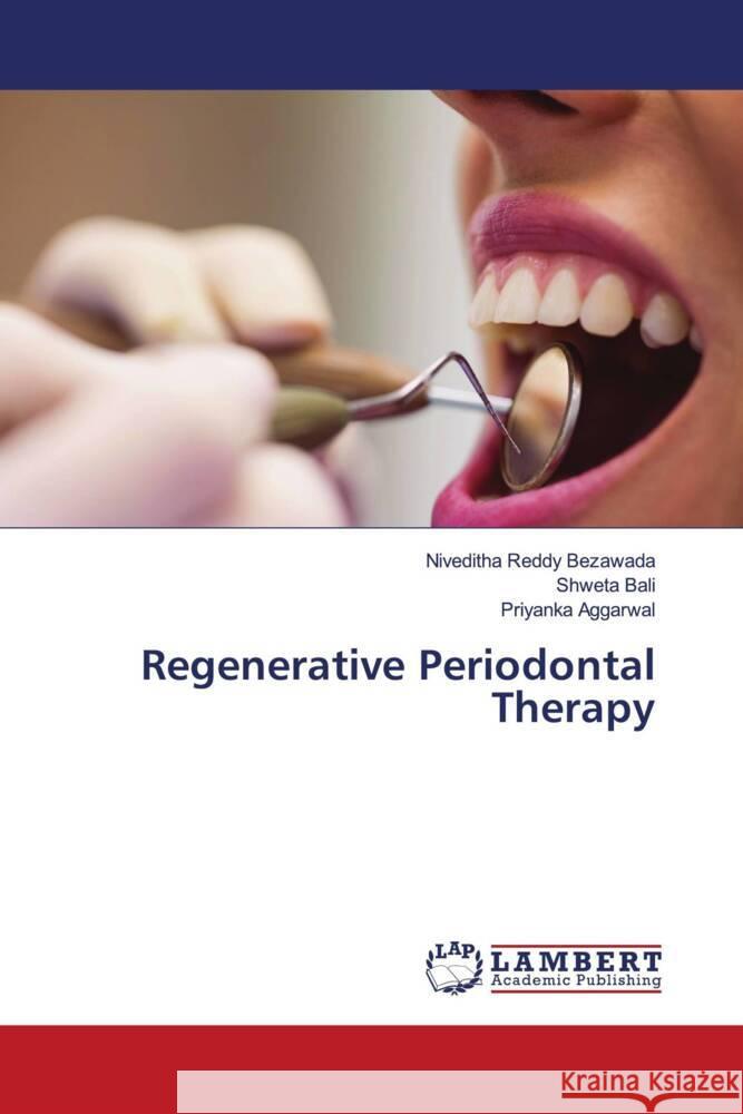 Regenerative Periodontal Therapy Bezawada, Niveditha Reddy, Bali, Shweta, Aggarwal, Priyanka 9786203308969