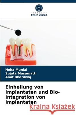 Einheilung von Implantaten und Bio- Integration von Implantaten Neha Munjal, Sujata Masamatti, Amit Bhardwaj 9786203318081