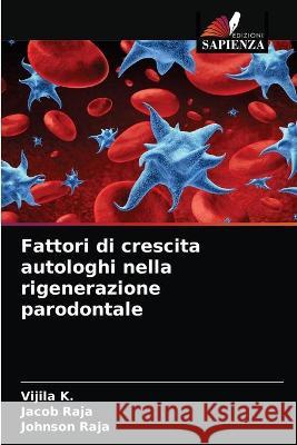 Fattori di crescita autologhi nella rigenerazione parodontale Raja Johnson Raja 9786203330236