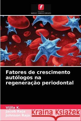 Fatores de crescimento autólogos na regeneração periodontal Vijila K, Jacob Raja, Johnson Raja 9786203330267