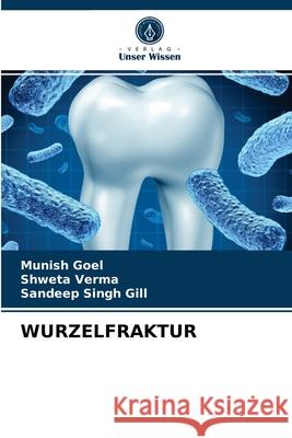 Wurzelfraktur Munish Goel, Shweta Verma, Sandeep Singh Gill 9786203350470