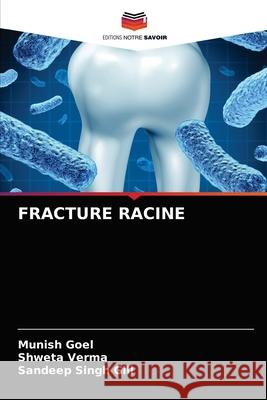 Fracture Racine Munish Goel, Shweta Verma, Sandeep Singh Gill 9786203350494 Editions Notre Savoir