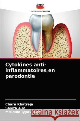 Cytokines anti-inflammatoires en parodontie Charu Khatreja, Savita A M, Mrudula Iyyakkattil 9786203359121 Editions Notre Savoir