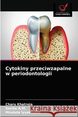 Cytokiny przeciwzapalne w periodontologii Charu Khatreja, Savita A M, Mrudula Iyyakkattil 9786203359183 Wydawnictwo Nasza Wiedza