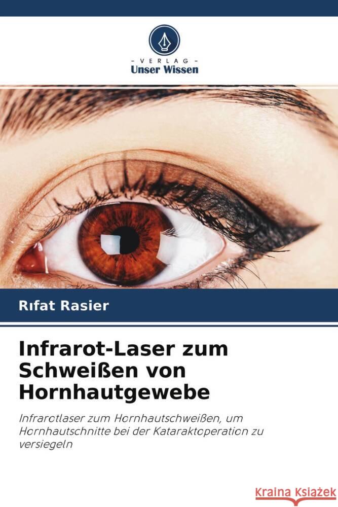 Infrarot-Laser zum Schweißen von Hornhautgewebe Rasier, Rifat 9786203379624