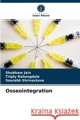 Osseointegration Shubham Jain, Tripty Rahangdale, Saurabh Shrivastava 9786203398885 Verlag Unser Wissen