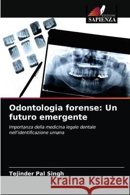 Odontologia forense: Un futuro emergente Tejinder Pal Singh 9786203401837