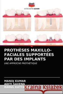 Prothèses Maxillo-Faciales Supportées Par Des Implants Manoj Kumar, Aditi Saxena, Rahul Katyayan 9786203402490 Editions Notre Savoir