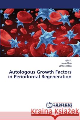 Autologous Growth Factors in Periodontal Regeneration Vijila K Jacob Raja Johnson Raja 9786203409550 LAP Lambert Academic Publishing