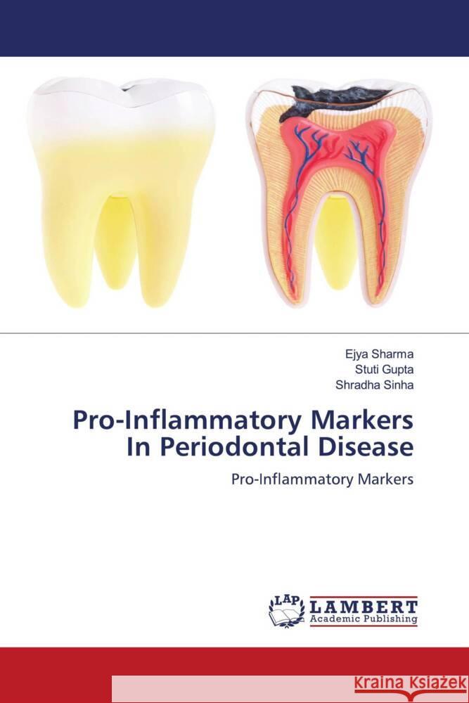 Pro-Inflammatory Markers In Periodontal Disease Sharma, Ejya, Gupta, Stuti, Sinha, Shradha 9786203410167