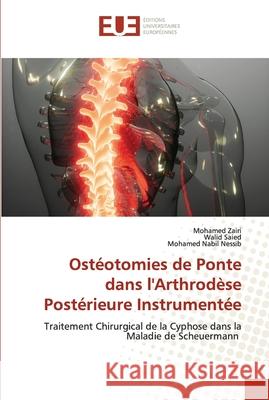 Ostéotomies de Ponte dans l'Arthrodèse Postérieure Instrumentée Zairi, Mohamed 9786203424287