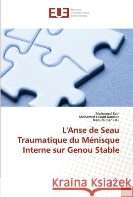 L'Anse de Seau Traumatique du Ménisque Interne sur Genou Stable Zairi, Mohamed 9786203424478 Editions Universitaires Europeennes