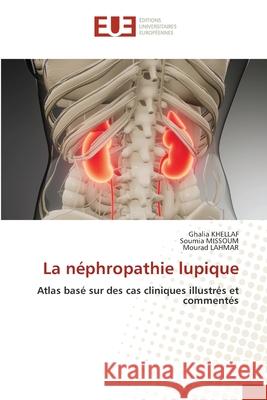 La néphropathie lupique Khellaf, Ghalia 9786203424973