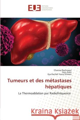 Tumeurs et des métastases hépatiques Dachraoui, Chaima 9786203429701