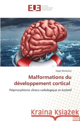 Malformations du développement cortical Barakizou, Hager 9786203433548