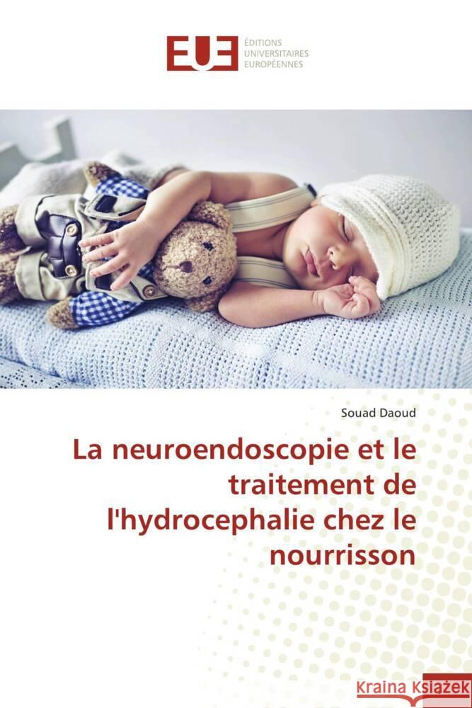 La neuroendoscopie et le traitement de l'hydrocephalie chez le nourrisson Daoud, Souad 9786203437003 Éditions universitaires européennes