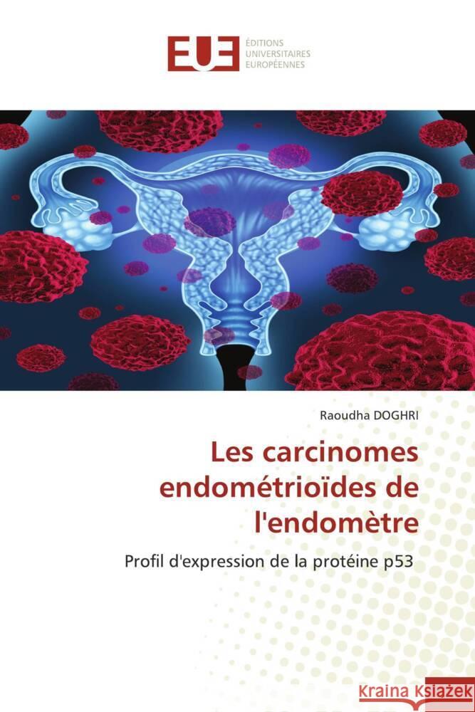 Les carcinomes endométrioïdes de l'endomètre DOGHRI, Raoudha 9786203438468