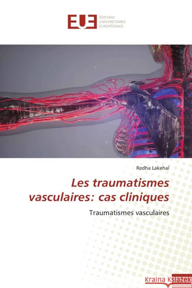 Les traumatismes vasculaires: cas cliniques Lakehal, Redha 9786203441574