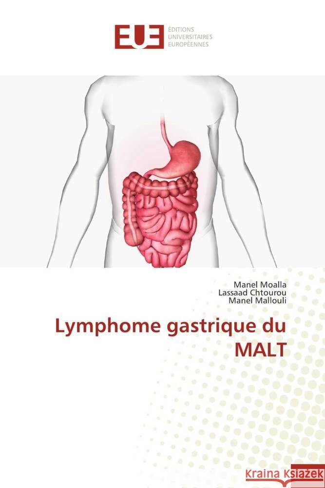 Lymphome gastrique du MALT MOALLA, Manel, Chtourou, Lassaad, Mallouli, Manel 9786203459470