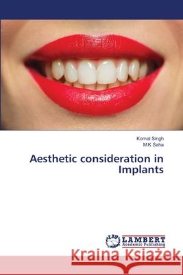 Aesthetic consideration in Implants Komal Singh M. K. Saha 9786203463668