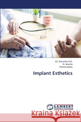 Implant Esthetics Ch Susmith G. Anusha Patcha Harika 9786203465099