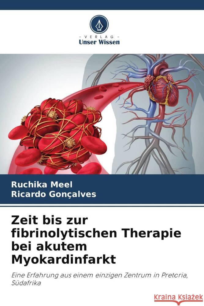 Zeit bis zur fibrinolytischen Therapie bei akutem Myokardinfarkt Meel, Ruchika, Gonçalves, Ricardo 9786203472134