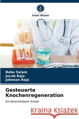 Gesteuerte Knochenregeneration Babu Salam, Jacob Raja, Johnson Raja 9786203480573