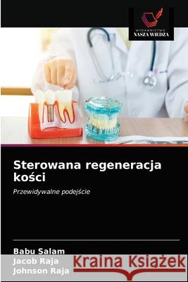 Sterowana regeneracja kości Salam, Babu 9786203480986 Wydawnictwo Nasza Wiedza