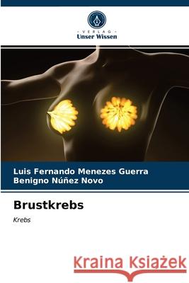 Brustkrebs Luis Fernando Menezes Guerra, Benigno Núñez Novo 9786203482218 Verlag Unser Wissen