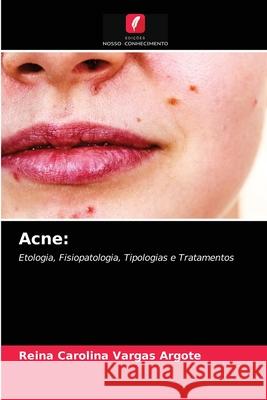 Acne Reina Carolina Vargas Argote 9786203482607