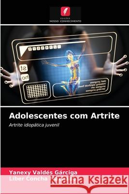 Adolescentes com Artrite Yanexy Valdés Gárciga, Liber Concha Machado 9786203497724 Edicoes Nosso Conhecimento