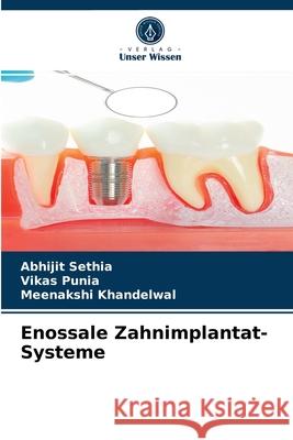 Enossale Zahnimplantat-Systeme Abhijit Sethia, Vikas Punia, Meenakshi Khandelwal 9786203507454