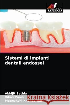 Sistemi di impianti dentali endossei Abhijit Sethia, Vikas Punia, Meenakshi Khandelwal 9786203507461