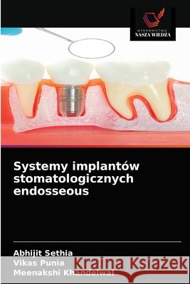 Systemy implantów stomatologicznych endosseous Abhijit Sethia, Vikas Punia, Meenakshi Khandelwal 9786203507492