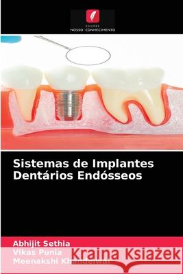 Sistemas de Implantes Dentários Endósseos Abhijit Sethia, Vikas Punia, Meenakshi Khandelwal 9786203507508