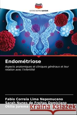 Endométriose Lima Nepomuceno, Fabio Correia 9786203511994