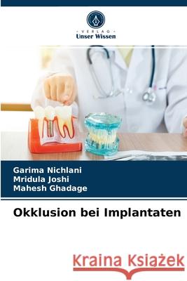 Okklusion bei Implantaten Garima Nichlani, Mridula Joshi, Mahesh Ghadage 9786203523478