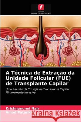 A Técnica de Extração da Unidade Folicular (FUE) de Transplante Capilar Krishnanunni Nair, Amod Patankar 9786203536157